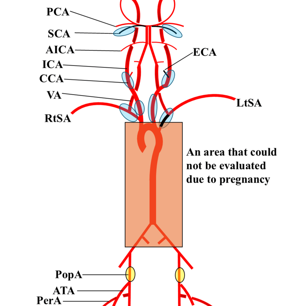 Regional Cerebral Oxygen Saturation Monitoring in an Emergency Cesarean Section for Takayasu Arteritis: A Case Report on Utility and Limitations