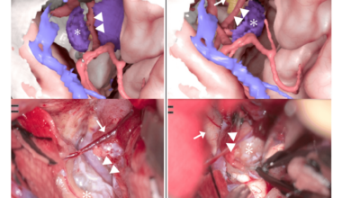 A Comprehensive Three-Dimensional Simulation Method for Skull Base Meningioma Surgery