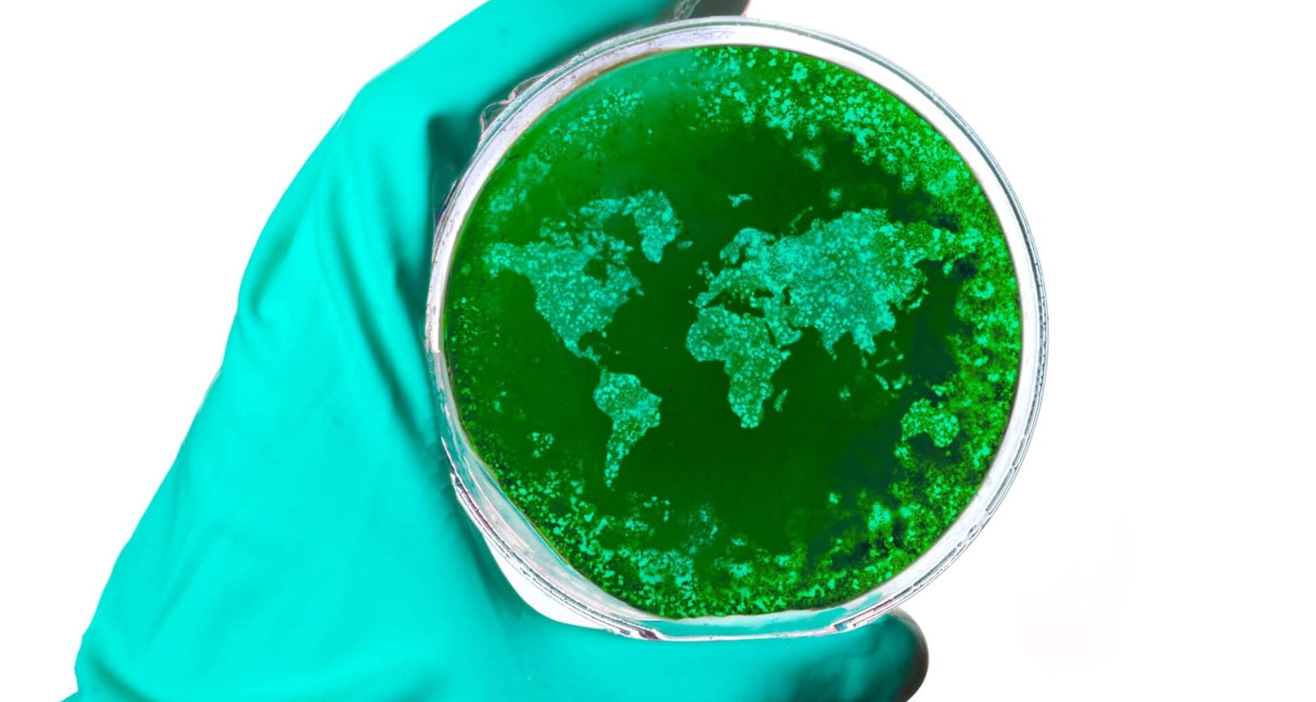 Tuberculosis Survivors Face Elevated Mortality Risk for 14 Years After Treatment