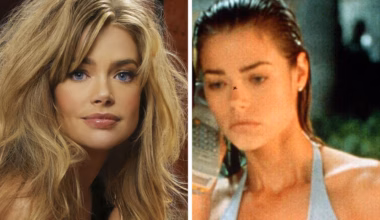Denise Richards shares jaw-dropping before and after facelift photos