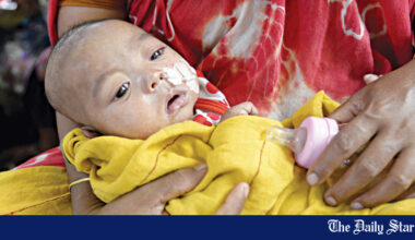 At least 38 children dead in measles outbreak