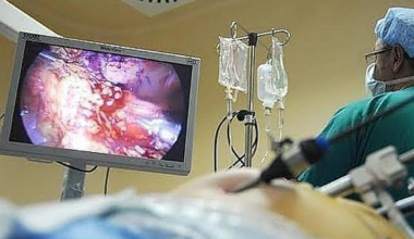 Seven out of ten Malaga residents do not respond to invitation for colon cancer screening