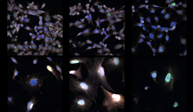 Signs of aging vary across brain cells