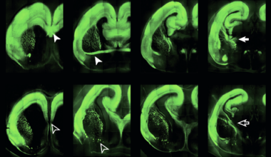 Cortical evolution, ZBTB18, and more