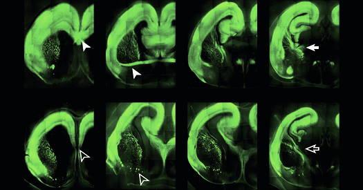 Cortical evolution, ZBTB18, and more
