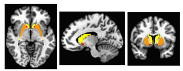 brain scans