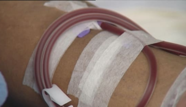 Christchurch dialysis patients told treatment could be rationed