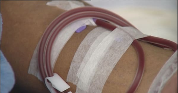 Christchurch dialysis patients told treatment could be rationed