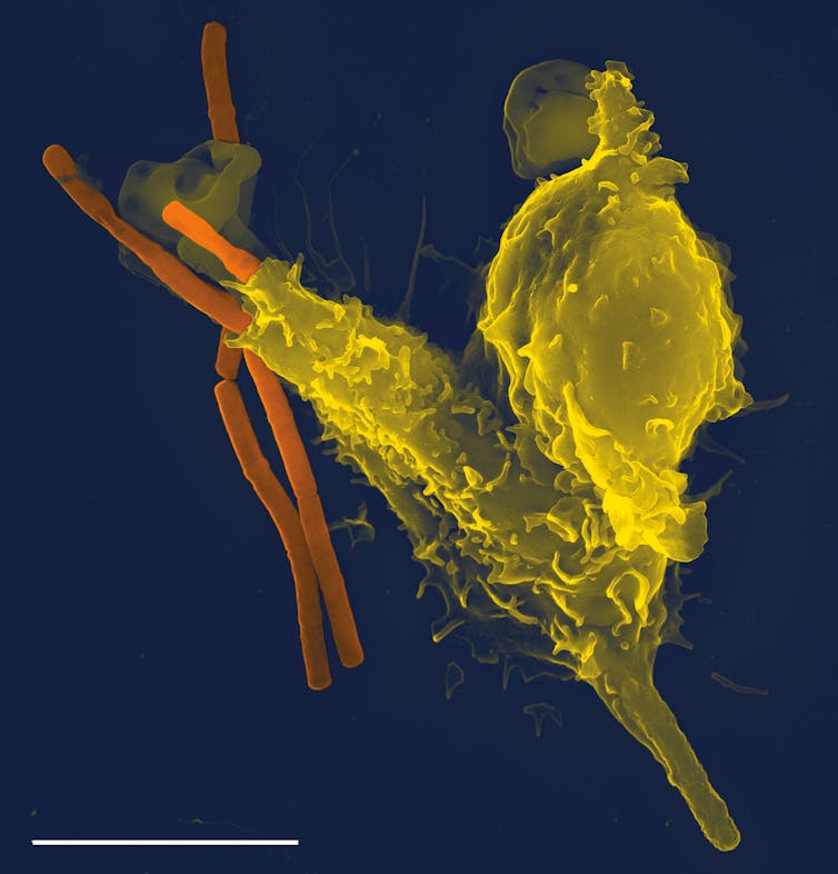 Microscopy image of two or three long, thin orange rods being swallowed by two yellow blobs