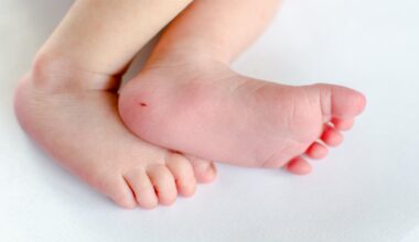 Testing newborns for spinal muscular atrophy – screening programme begins in Scotland