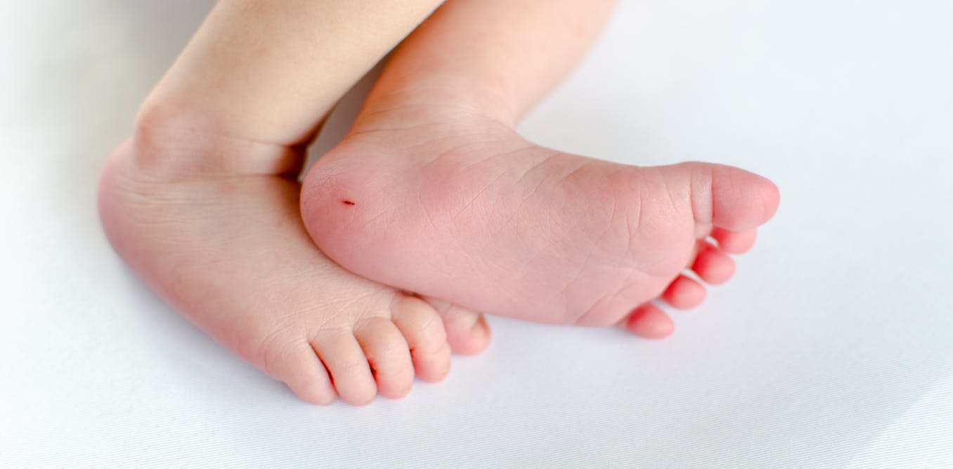 Testing newborns for spinal muscular atrophy – screening programme begins in Scotland