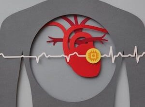 Study Shows AI Model Can Accurately Read Cardiac MRI Scans  