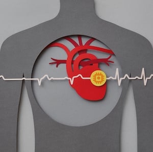 Study Shows AI Model Can Accurately Read Cardiac MRI Scans  