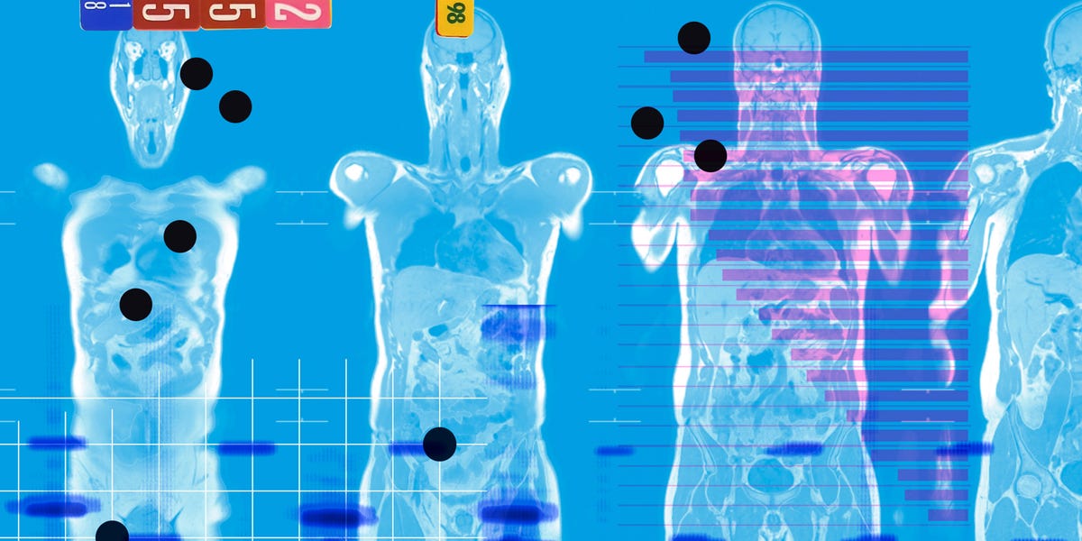 What Full Body MRIs and Cancer Blood Tests Really Offer