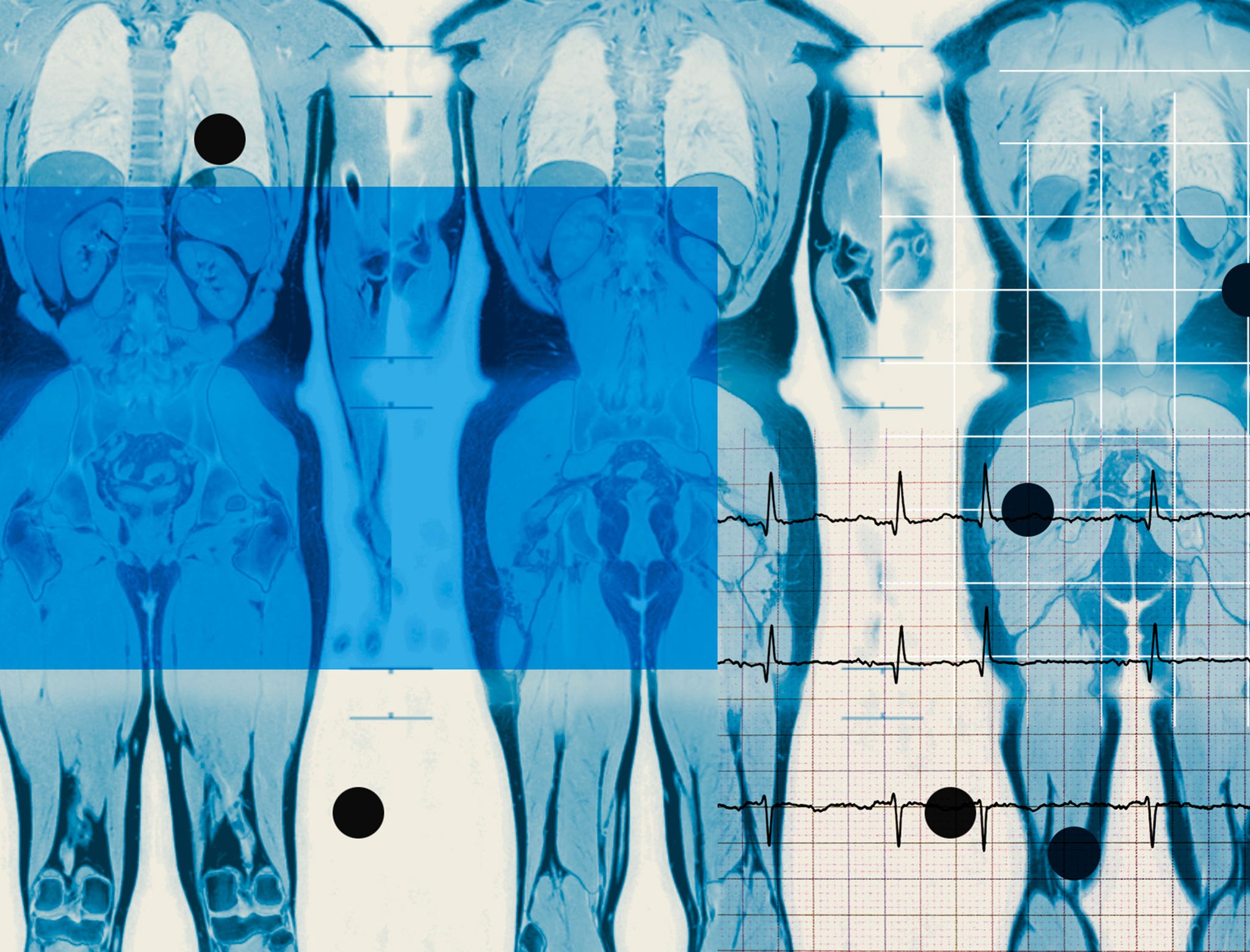 medical imaging featuring anatomical views alongside heartbeat graphs