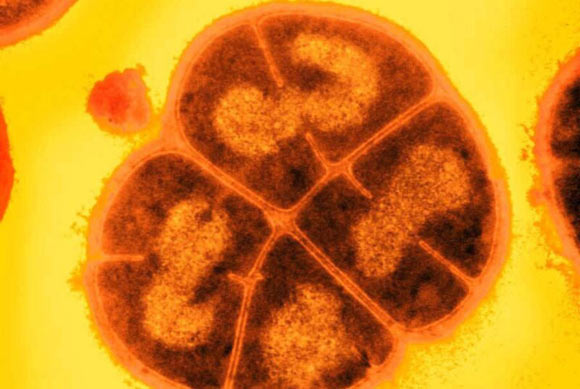 Deinococcus radiodurans. Image credit: USU / Michael Daly.