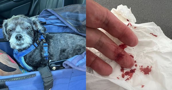 Auckland councillor bitten by dog while protecting pet