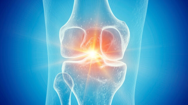illustration of a knee joint