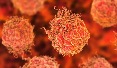 Low testosterone may signal high-risk prostate cancer