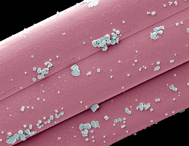 New nanoparticle therapy overcomes T cell exhaustion in solid tumors