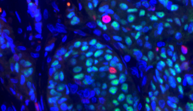 Bringing proteins together to take cancer apart