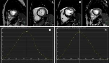 AI-enhanced MRI enables single-shot imaging of cardiac cycle • healthcare-in-europe.com