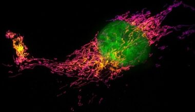 Understanding PIEZO2 mutations and sensory disorders