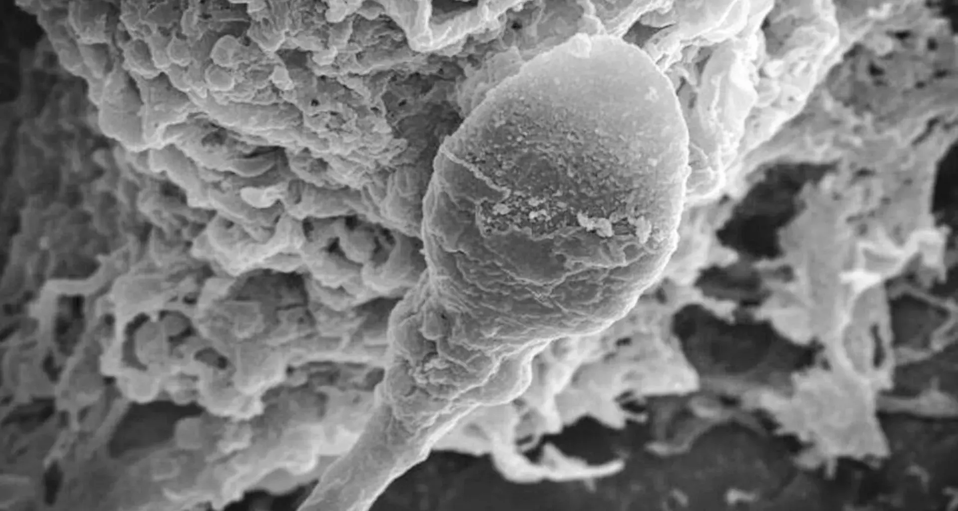 Lost in space: Microgravity makes sperm lose their sense of direction