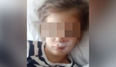 'Vicious' dog attack leaves six-year-old scarred for life