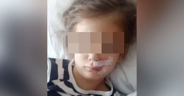 'Vicious' dog attack leaves six-year-old scarred for life