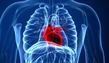 Why heart disease is on the rise among younger women