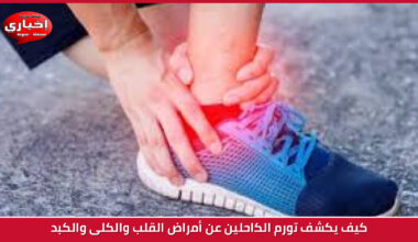 Key Inflation Gauge Rises in January, Dampening Hopes for Early Interest Rate Cuts