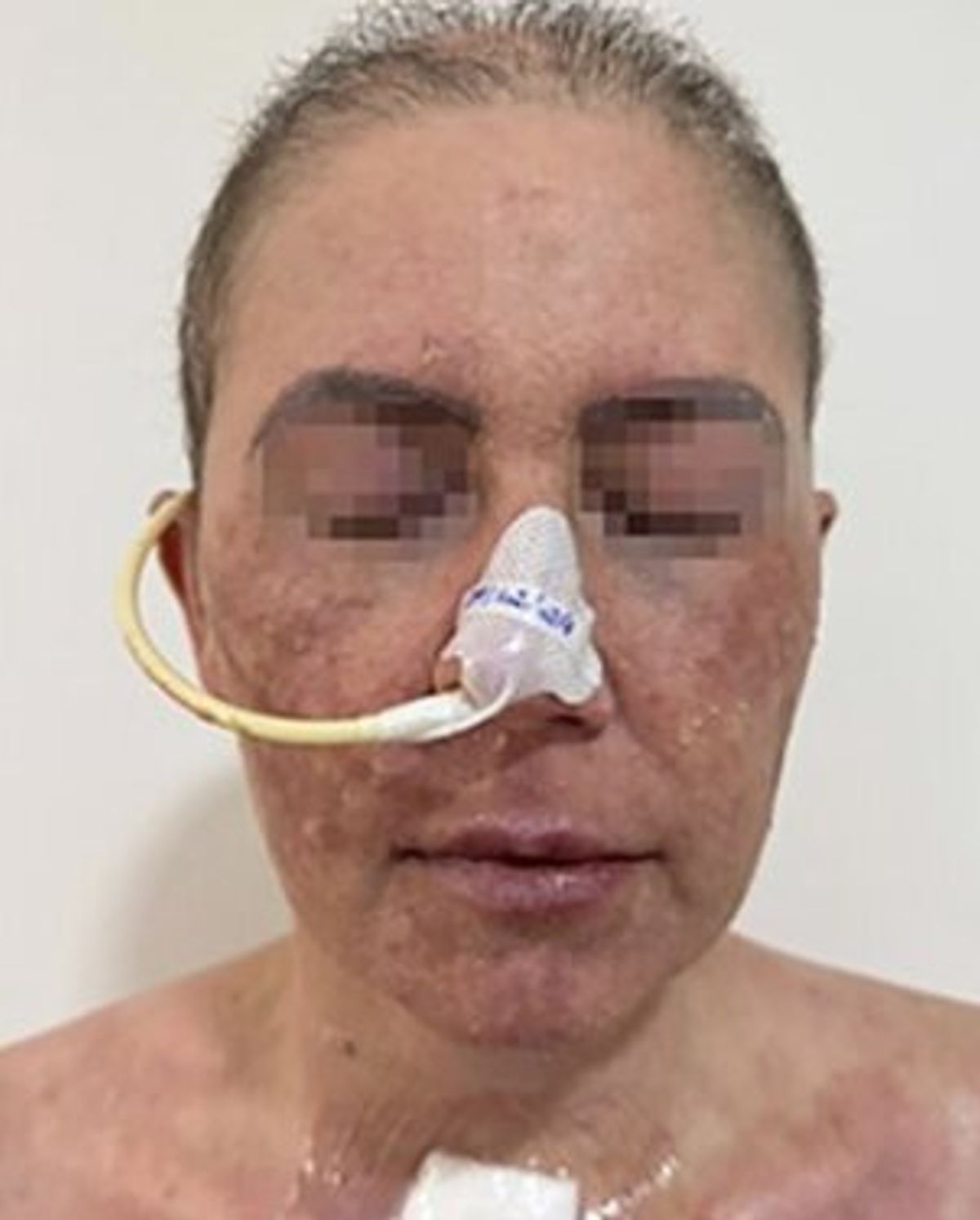 Day 66, when she was released from hospital