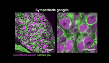 Rejji Kuruvilla discusses research on the development of the sympathetic nervous system