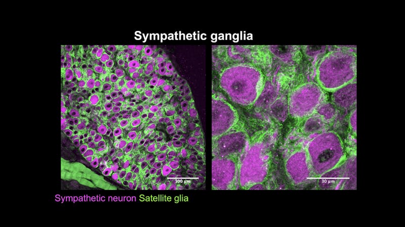 Rejji Kuruvilla discusses research on the development of the sympathetic nervous system