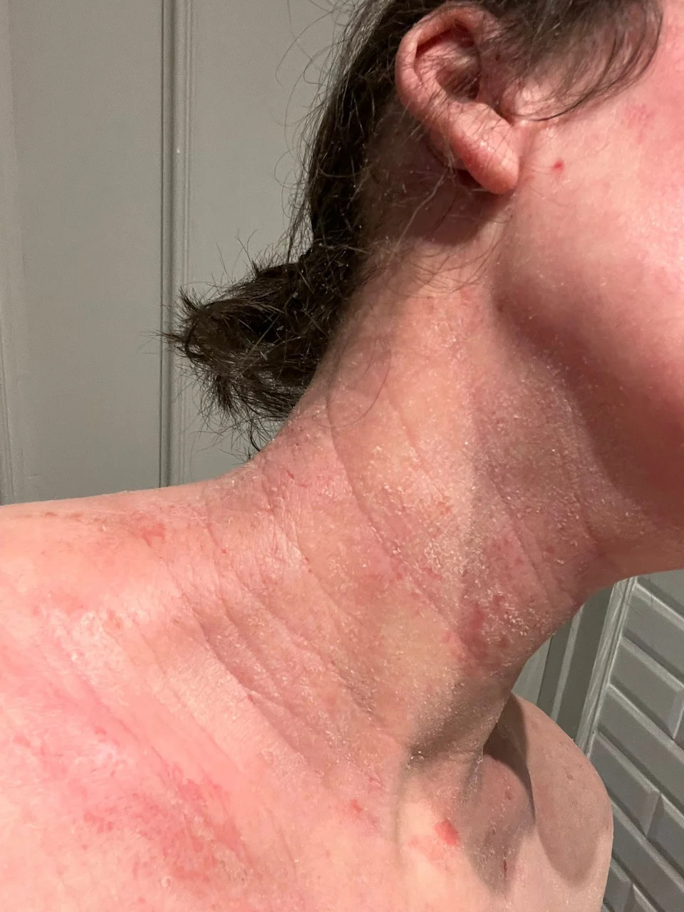 Rosemary's skin