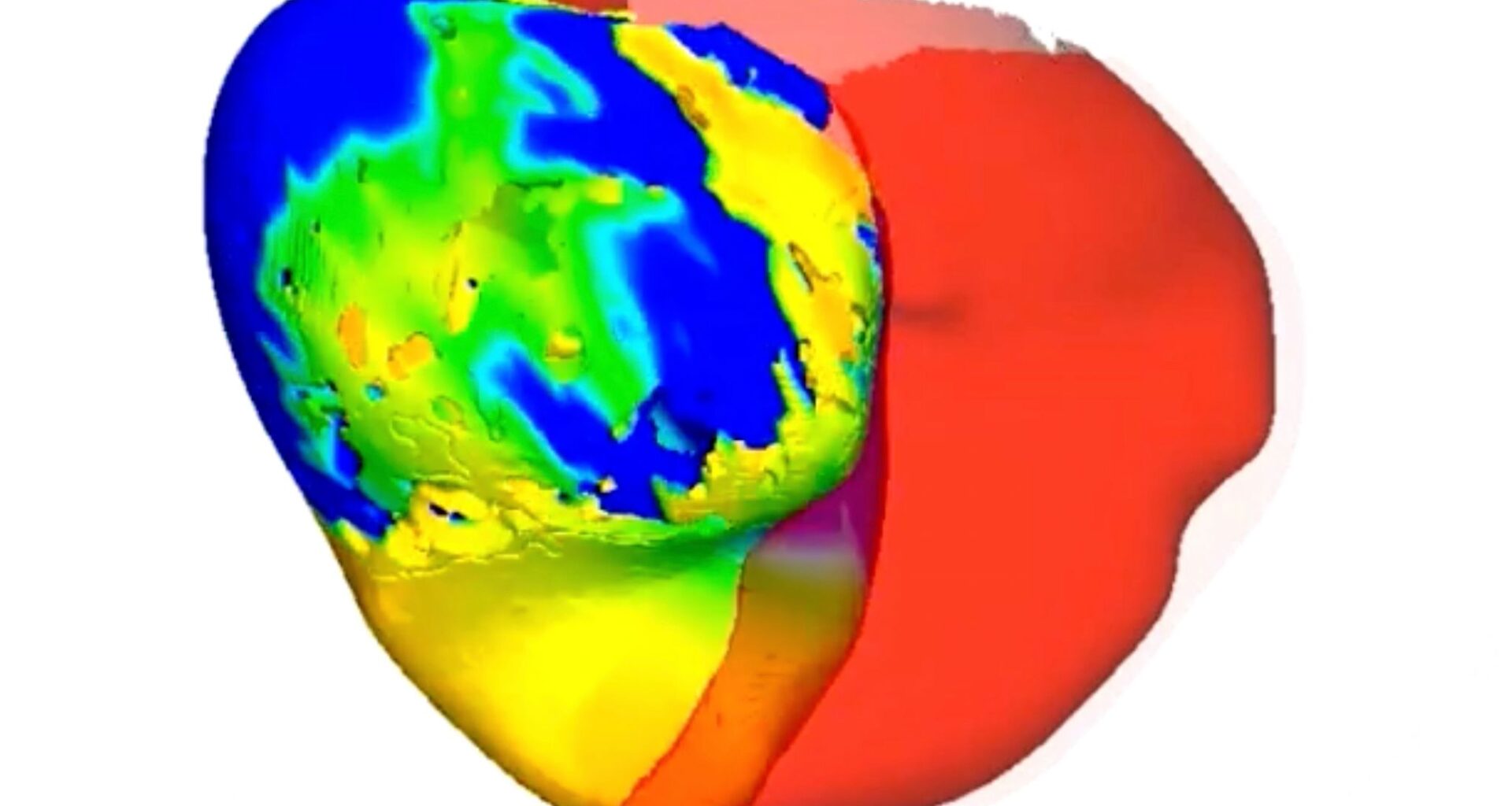 To fix a patient's irregular heartbeat, doctors first tested its digital 'twin'