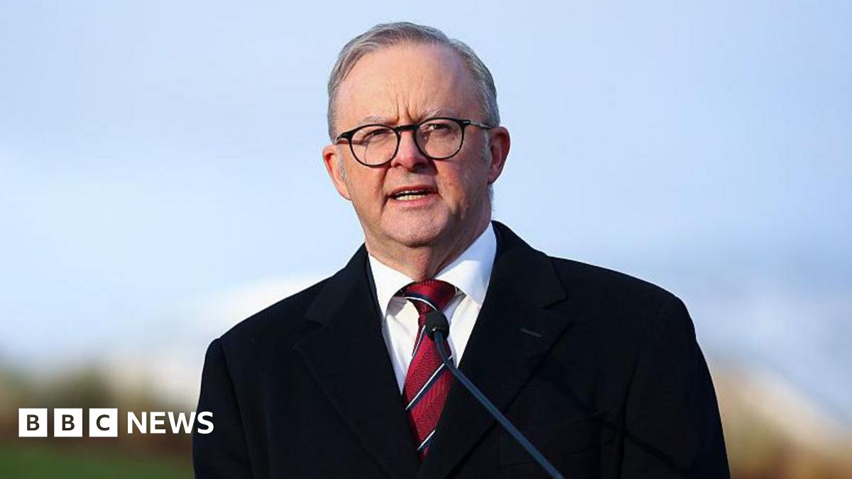 Anthony Albanese