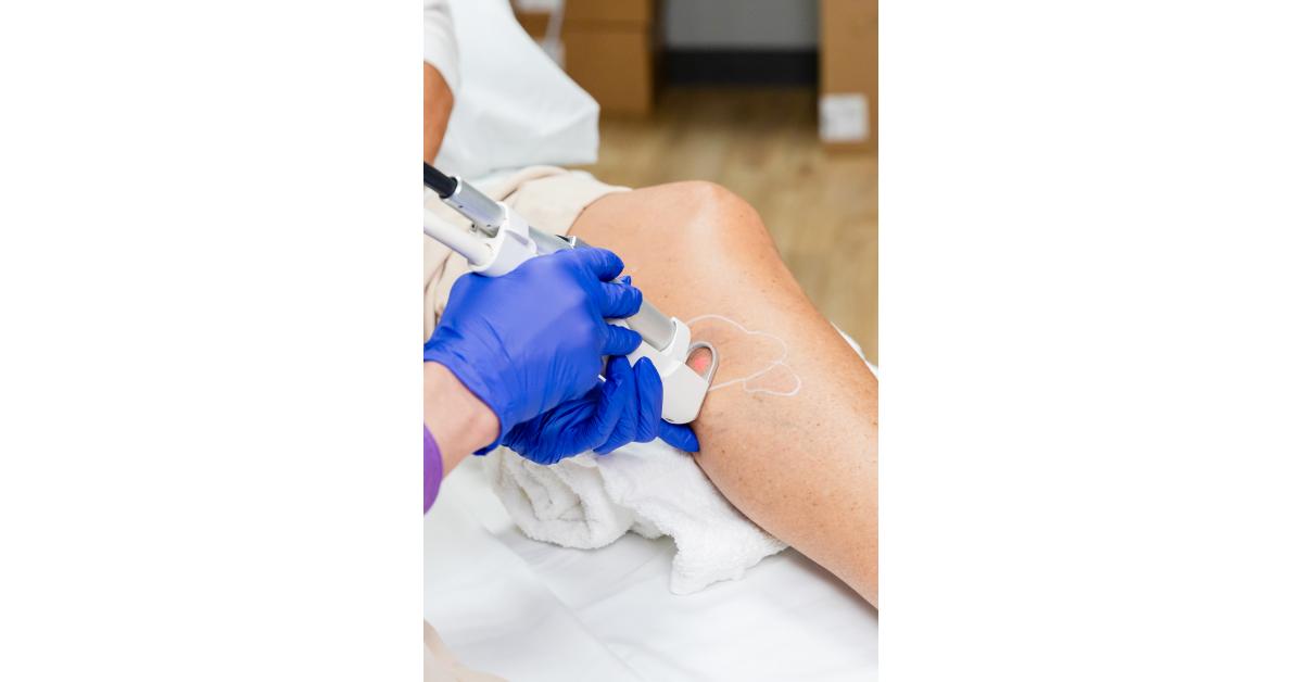 Akribis Veins & Vitality Encourages Early Treatment for Spider and Varicose Veins