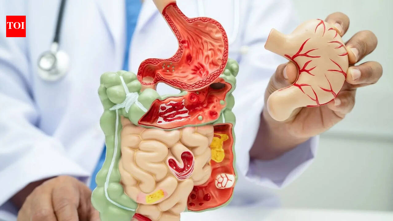 Autoimmune diseases may start in the gut: Early signs your immune system is turning against you and what you can do to restore balance