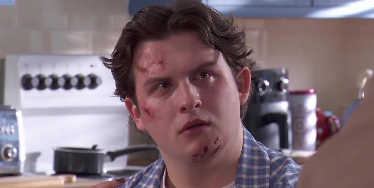 Hollyoaks confirms fate of injured characters in crash aftermath