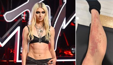 Taylor Momsen hospitalized after venomous spider bite on Mexico tour
