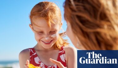 Red hair gene favoured by natural selection over last 10,000 years, study finds | Evolution