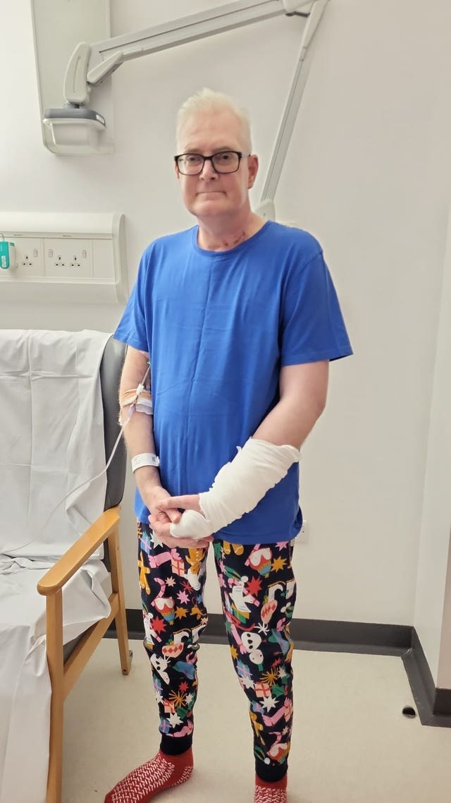 Darren White after his skin graft surgery 