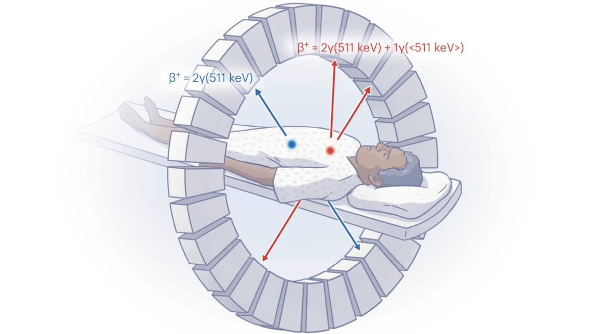 Multiplexed PET paves the way towards biologically individualized radiotherapy – Physics World