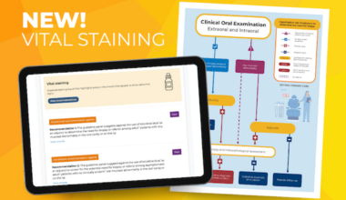 ADA guideline prioritizes clinical exam over vital staining in early oral cancer detection
