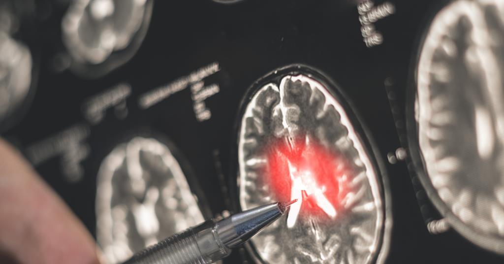 Natural compounds combined with antibodies show promise for safer Alzheimer's treatment