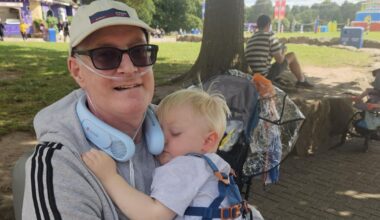 Skin patch from organ donor helped patient spot his new lung was being rejected