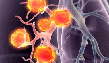 Addressing Unmet Needs in HER2+ Metastatic BTC