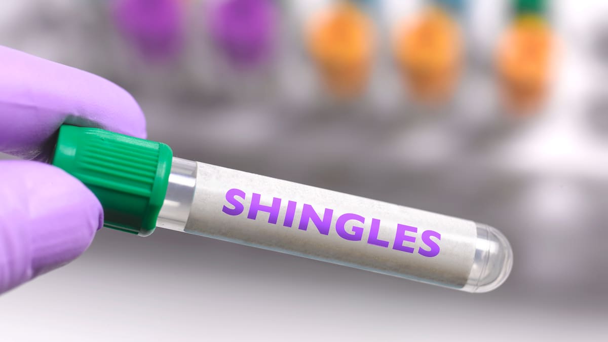 What it’s like dealing with shingles